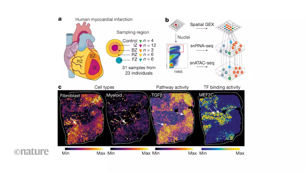 A map of the human heart after myocardial infarction