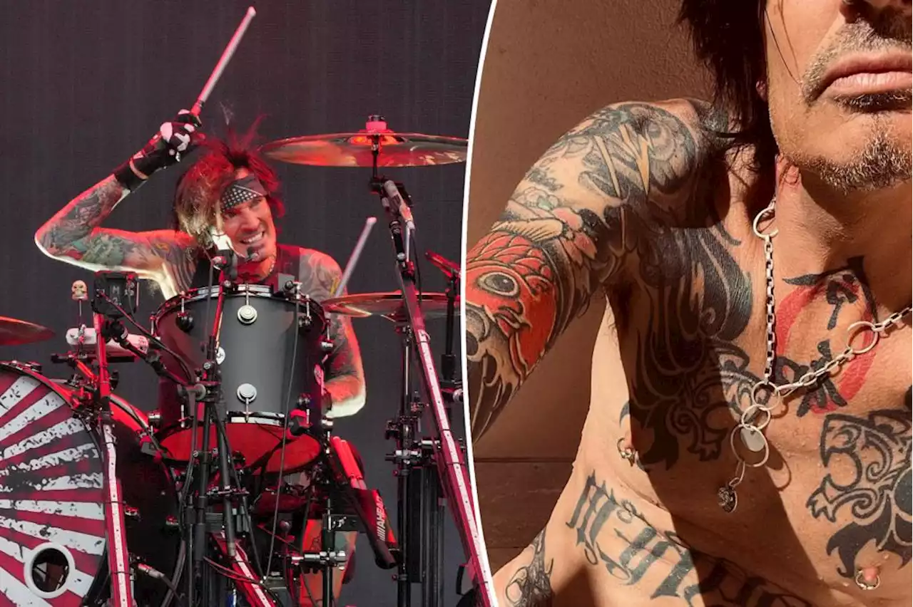 Mötley Crüe’s Tommy Lee posts full-frontal nude photo: ‘Ooooopppsss’