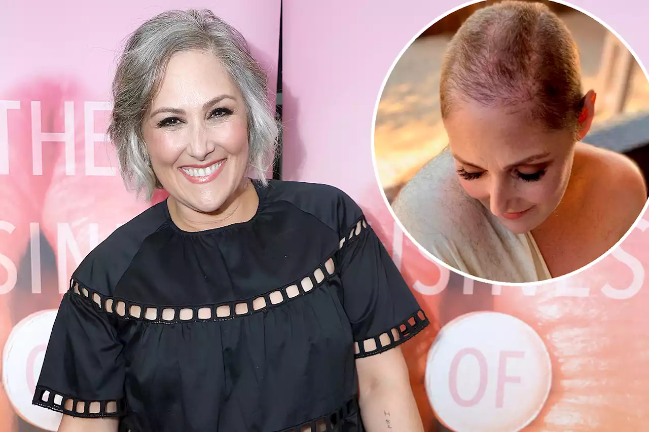 Ricki Lake shows transformation photos after hair loss and regrowth