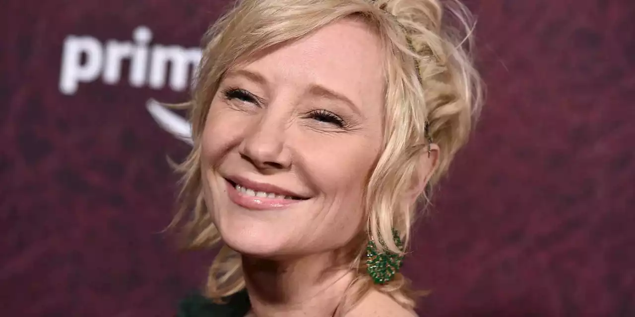 Anne Heche declared brain dead, kept on life support for organ donations