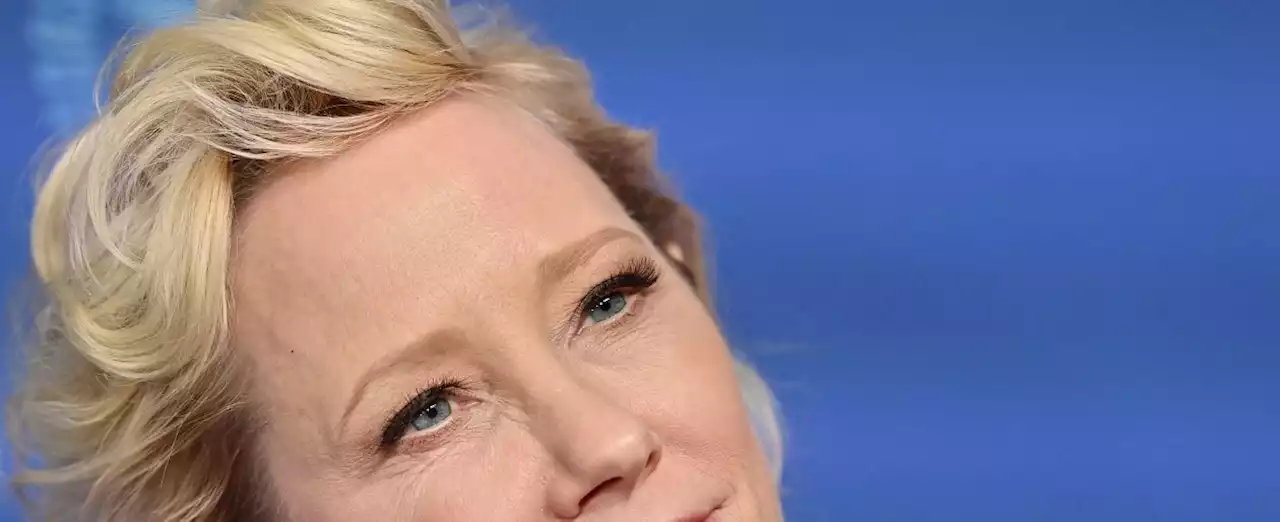 Anna Heche potrebbe non farcela. La famiglia: 'E' in condizioni critiche, non ci si aspetta che sopravviva'