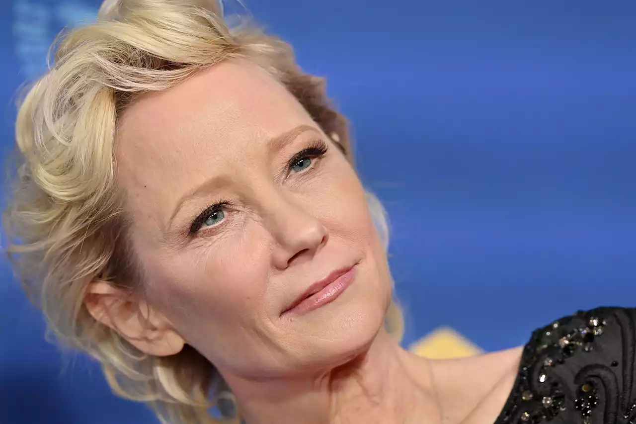 Anne Heche Dies After Being Taken Off Life Support