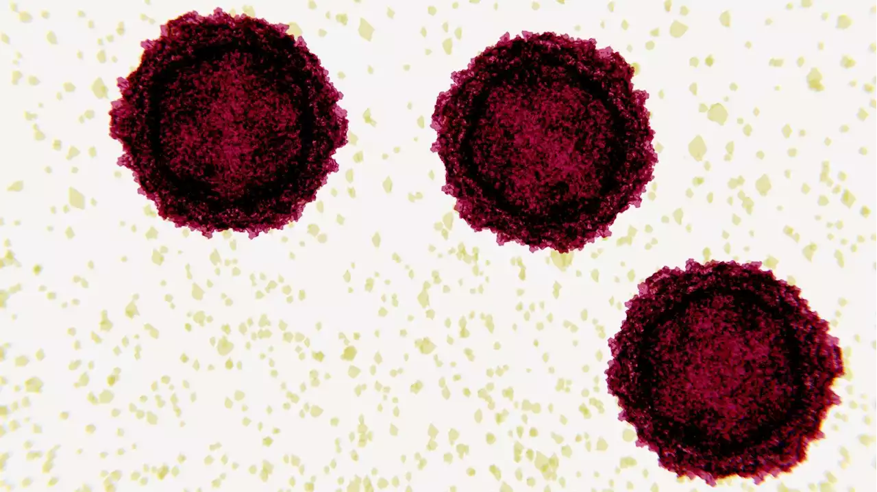 Virus that causes polio found in wastewater as first case of paralysis reported