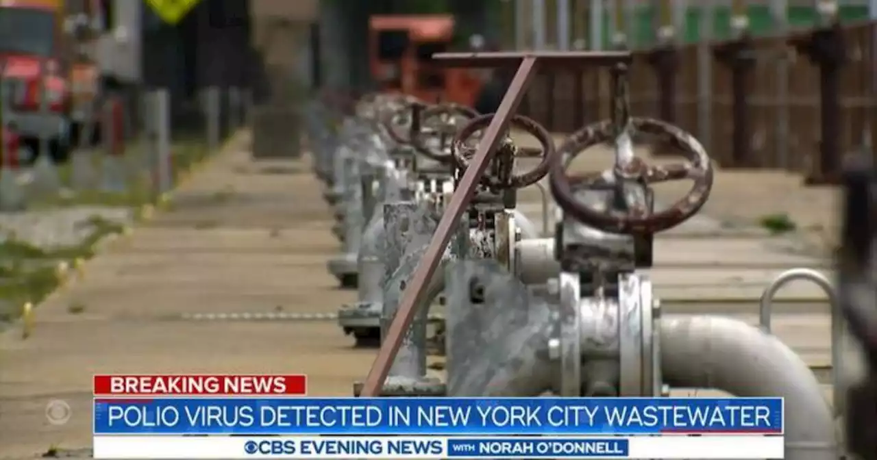 Polio detected in New York City wastewater