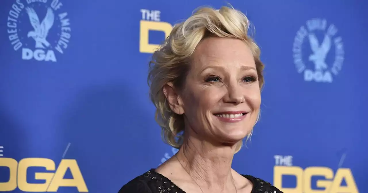 Anne Heche considered 'brain dead,' on life support for organ donation, representatives said