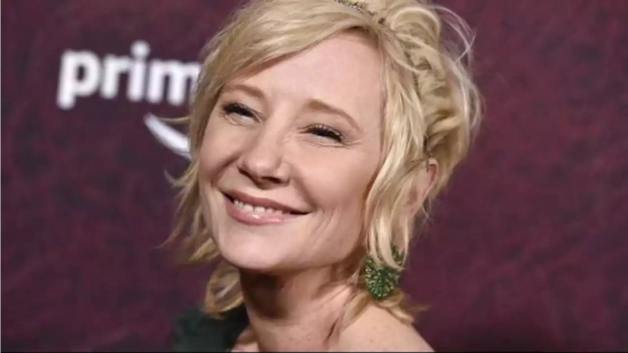 Anne Heche Meninggal Dunia di Usia 53 Tahun