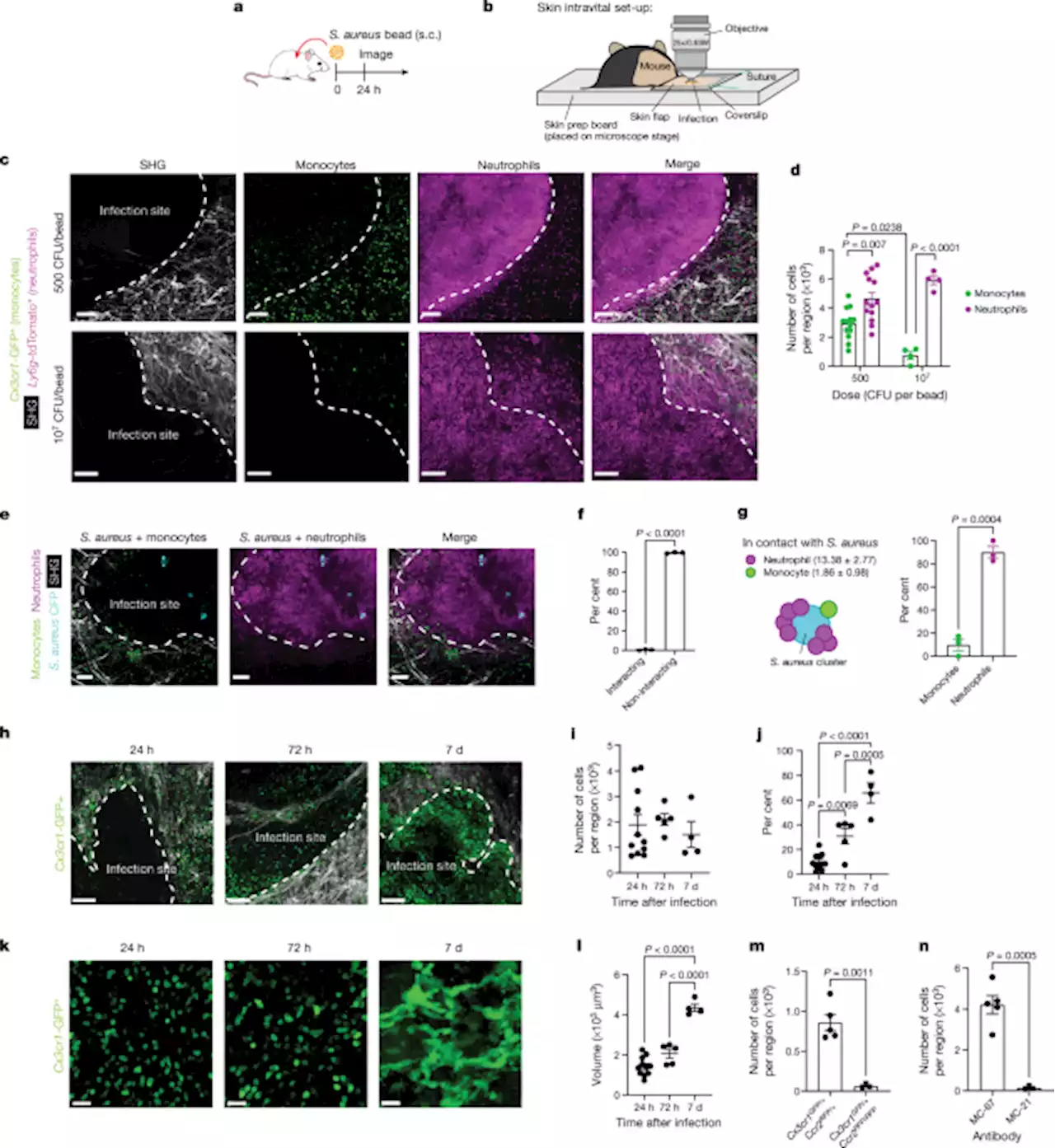 A monocyte–leptin–angiogenesis pathway critical for repair post-infection - Nature