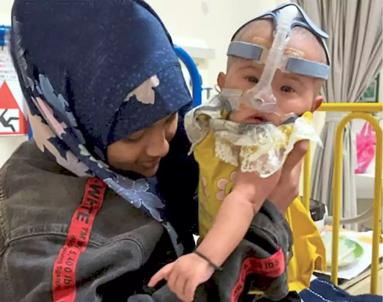 Five-month-old needs RM60,000 for heart surgery