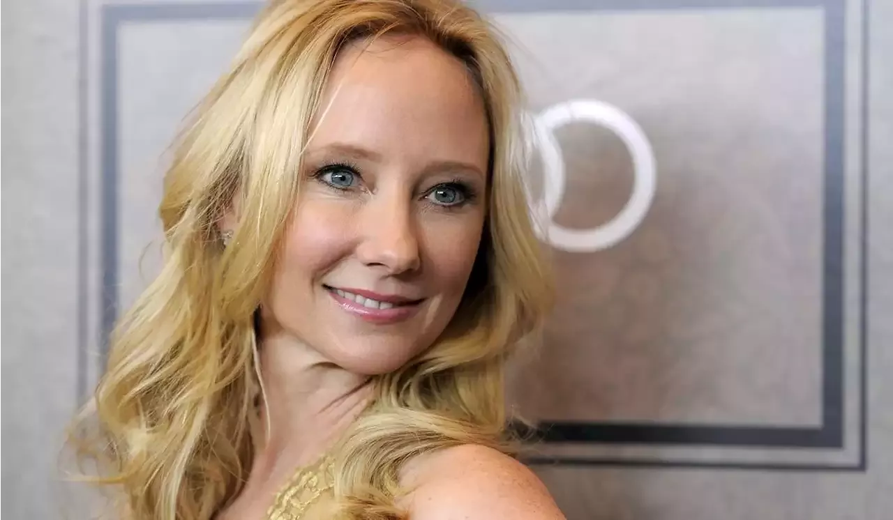 Actress Anne Heche Declared Legally Dead One Week After Crashing Car Into A Los Angeles House 7064