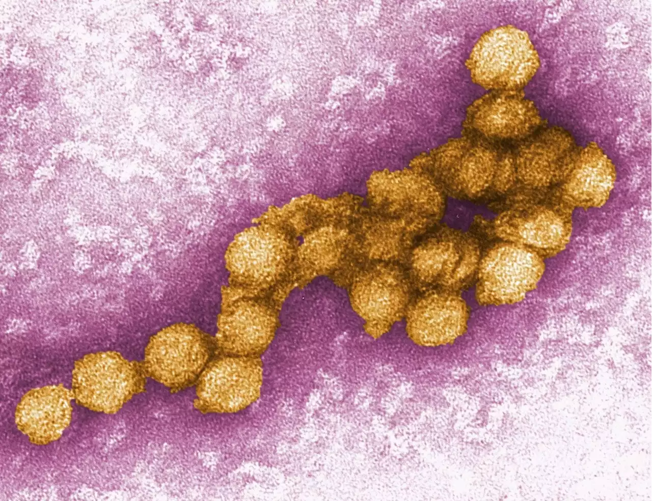 West-Nil-Virus: Fast 200 Menschen in der EU infiziert