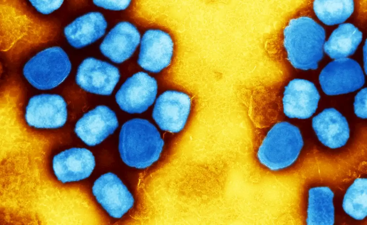 Africa: Monkeypox - Experts Give Virus Variants New Names