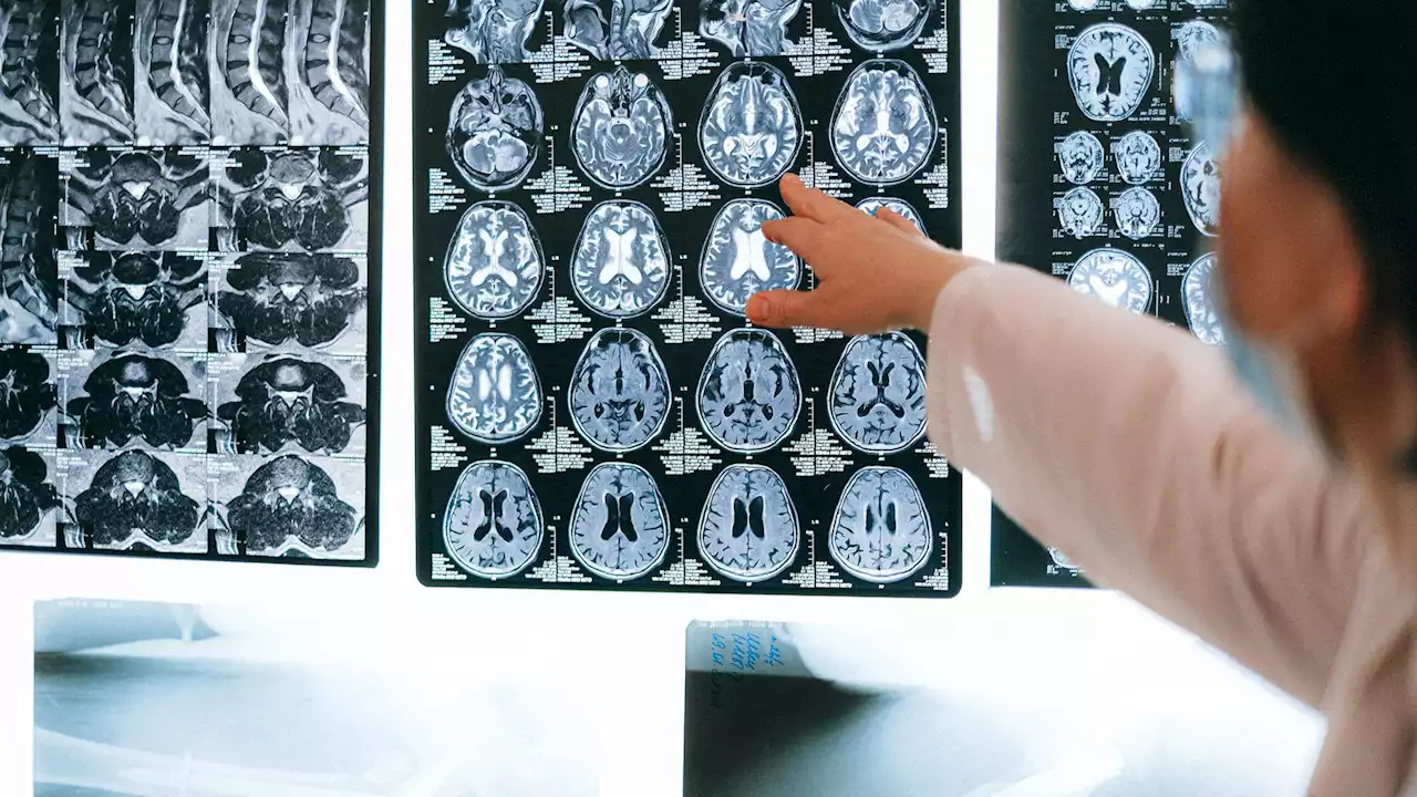 Brain scans measure students' learning better than exams — here's the proof