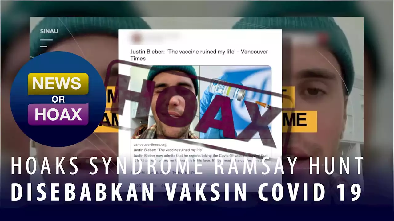 Hoax Syndrome Ramsay Hunt Disebabkan Vaksin Covid 19 - NEWS OR HOAX