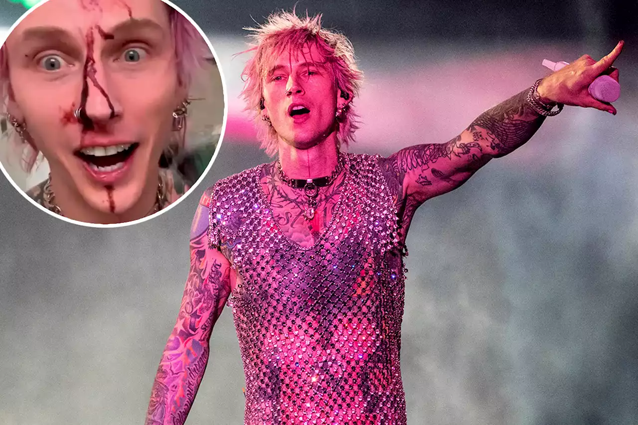 Machine Gun Kelly shows off bloody face after smashing wine glass on stage