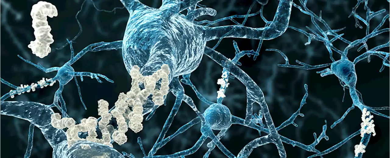 We Just Got More Evidence That Two Common Viruses Can Team Up to Trigger Alzheimer's