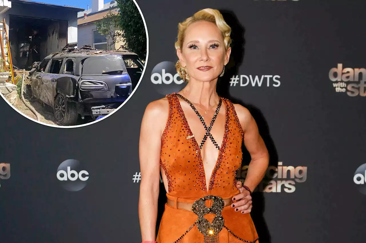 Anne Heche official cause of death revealed