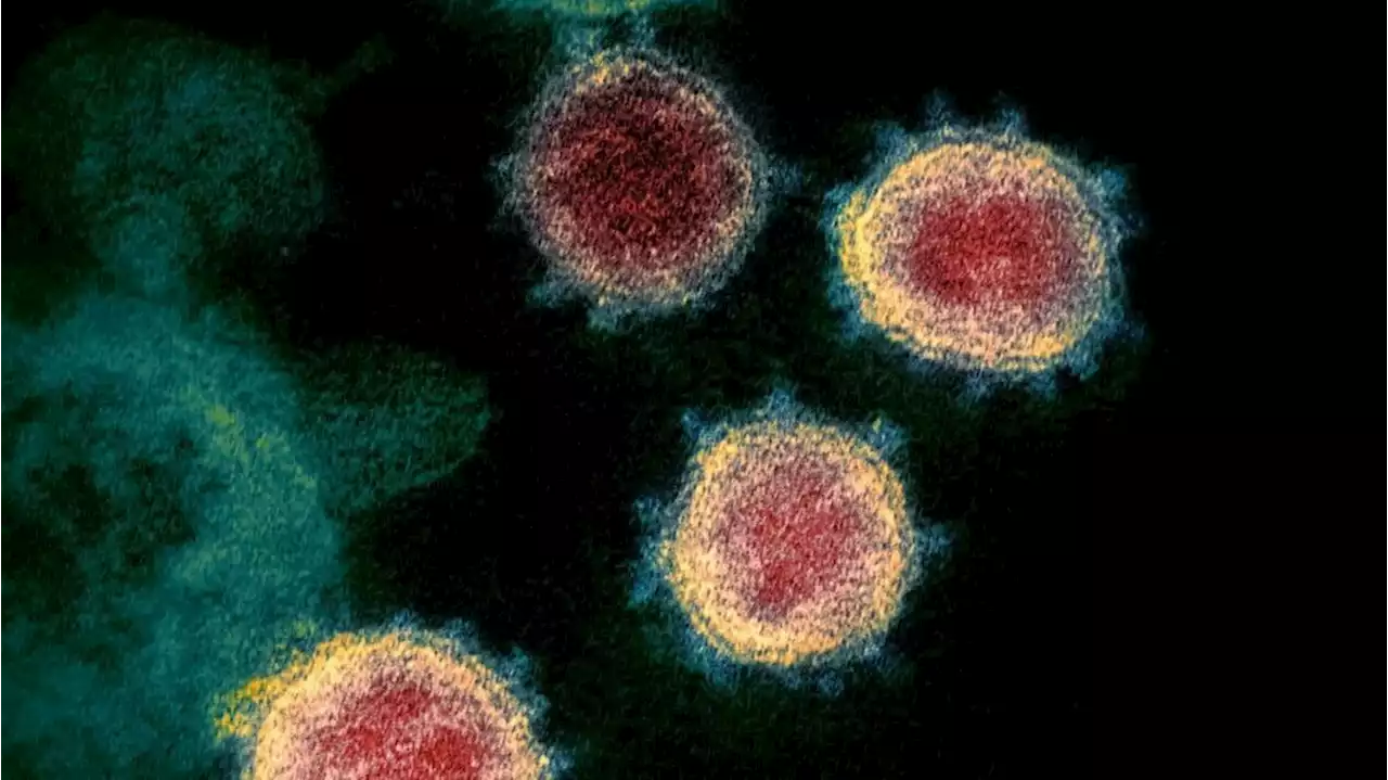 B.C. scientists find ‘weak spot’ in COVID-19 virus that could lead to new treatments - Terrace Standard