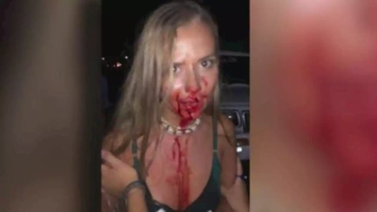 Houston woman viciously attacked in Sri Lanka, says suspected attacker is social media influencer