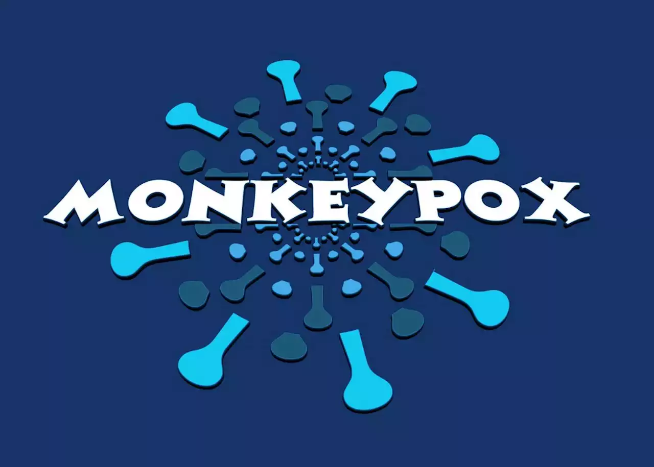 Monkeypox latest: SA told there's no need to vaccinate as yet
