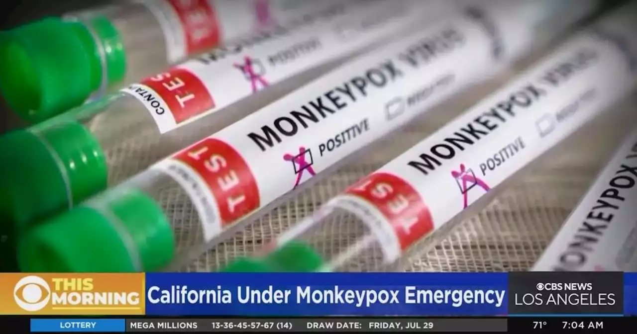 LA County Board of Supervisors issues proclamation of local emergency amid rising Monkeypox cases