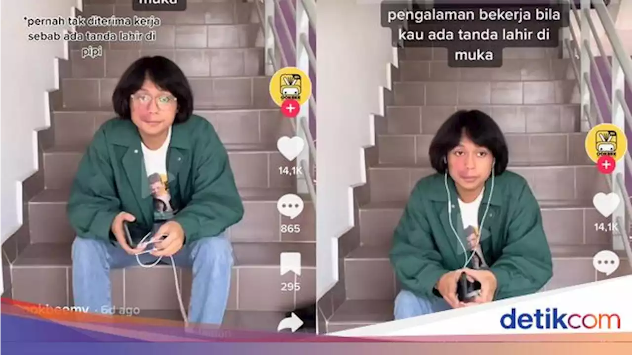 Viral Bikin Sedih, Cerita Pria Tak Diterima Kerja Gegara Tanda Lahir