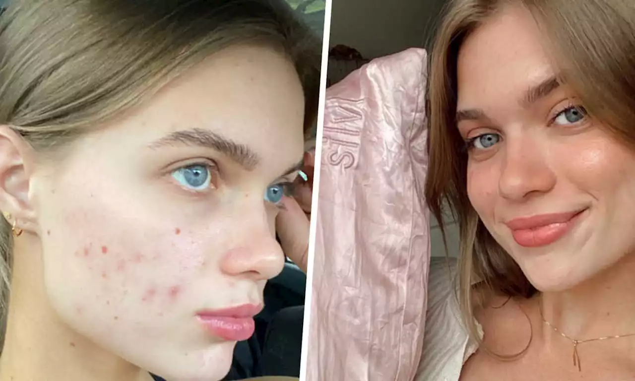 This anti-acne silk pillowcase will change your life and it's all over TikTok right now