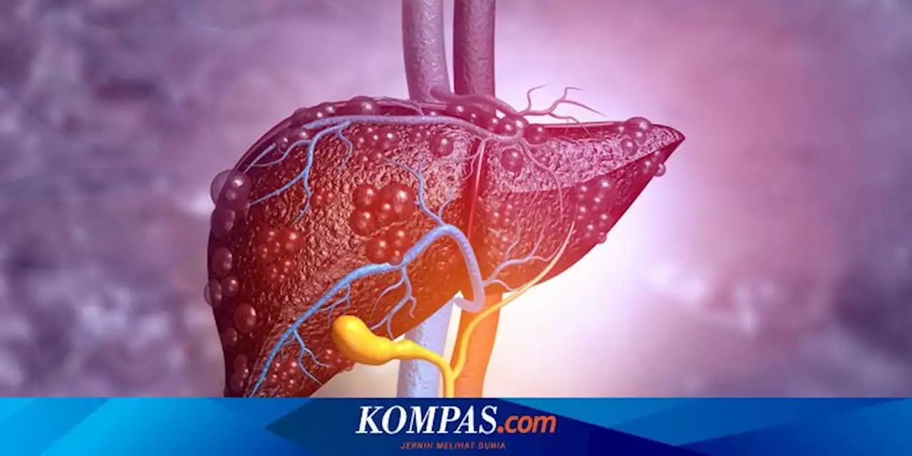 Apakah Sirosis Hati Bisa Sembuh? Simak Penjelasan Berikut...