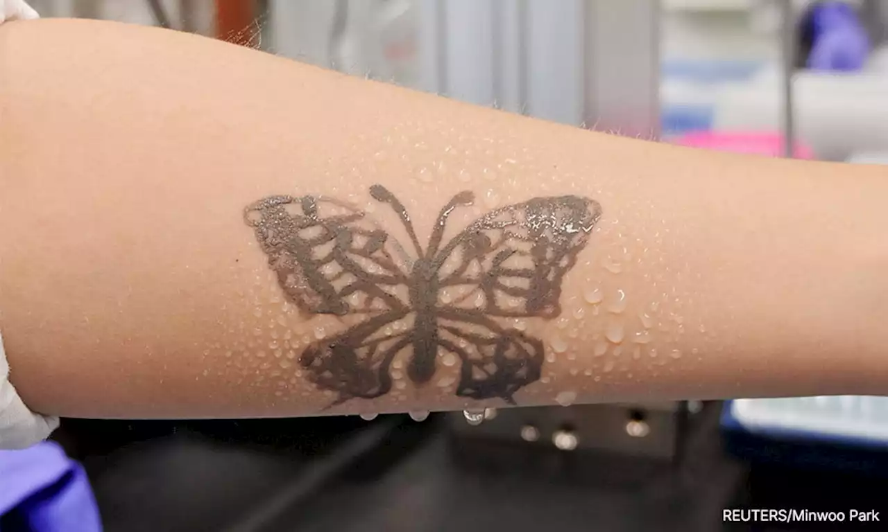 South Korea develops nanotech tattoo as health monitoring device