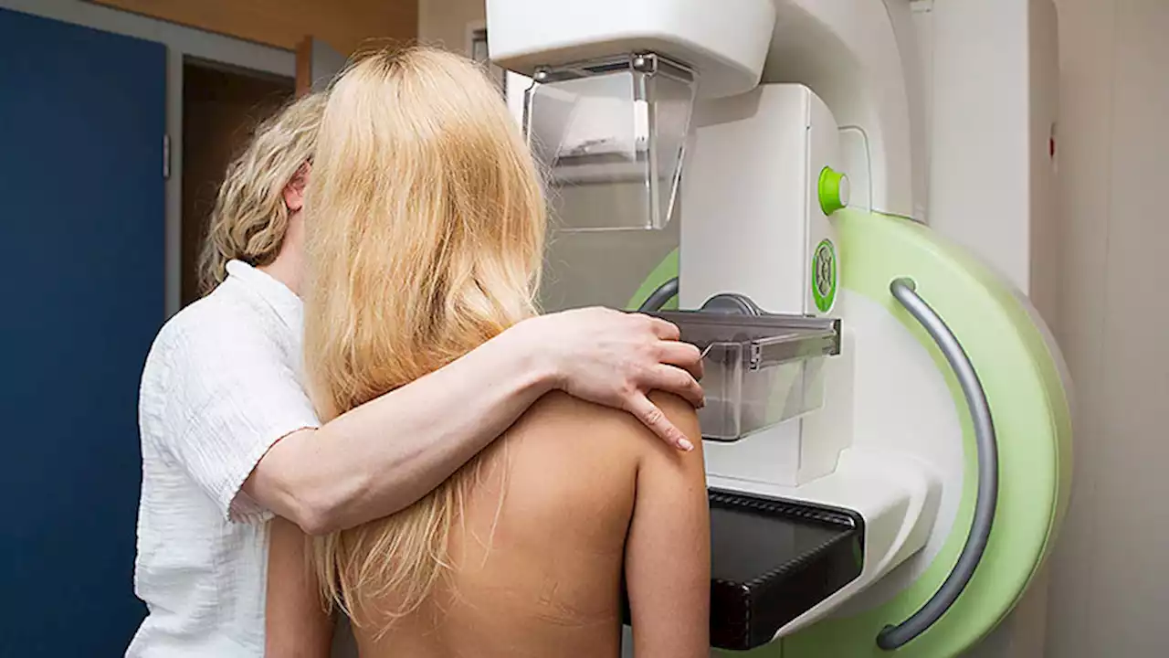 New NCCN Guidelines for Mammography: All Women Over 40