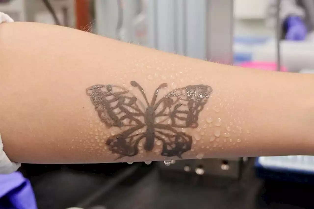 S. Korea develops nanotech tattoo as health monitoring device