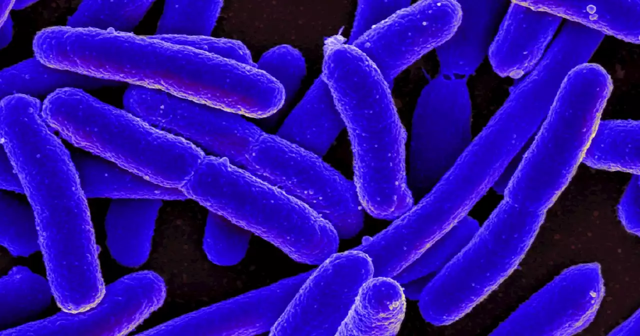 E. coli outbreak in Michigan and Ohio that has sickened 29 people is concerning, CDC says