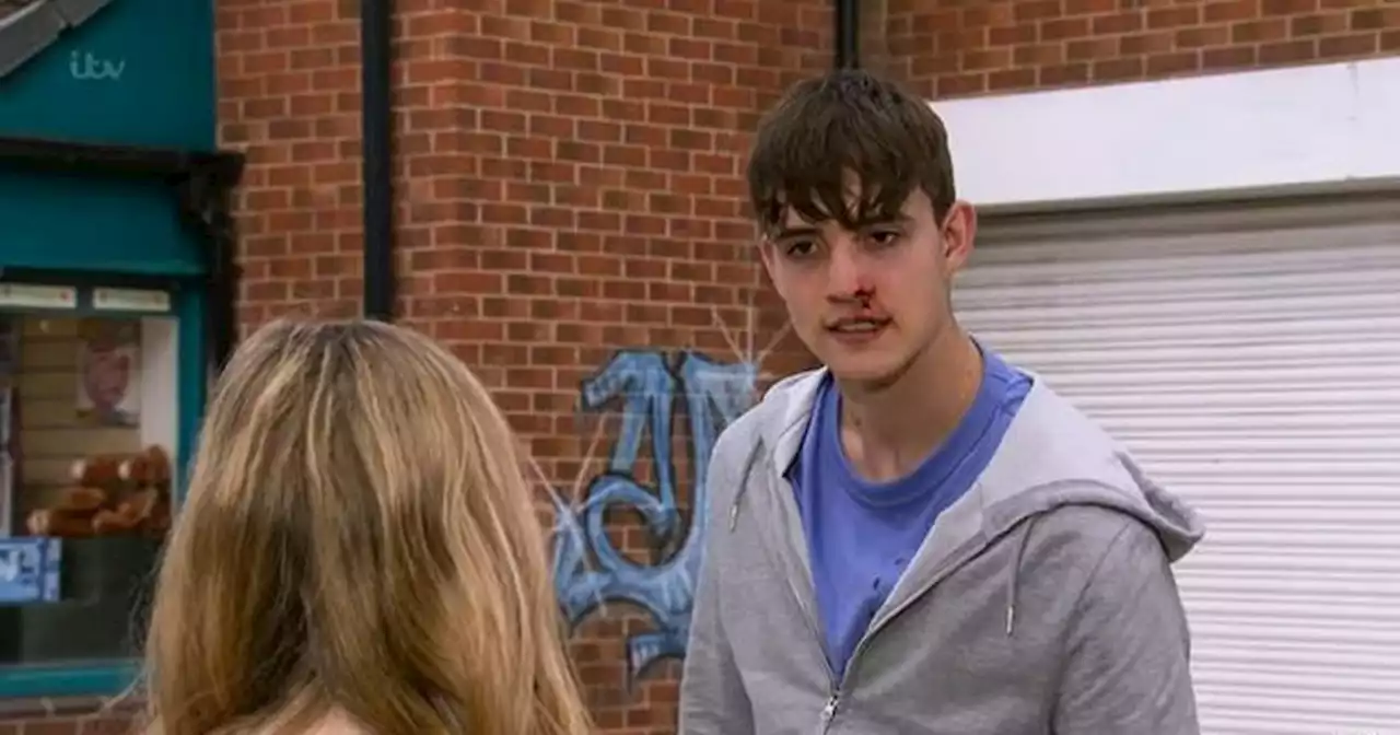 Coronation Street fans predict who Aaron's father is after abuse