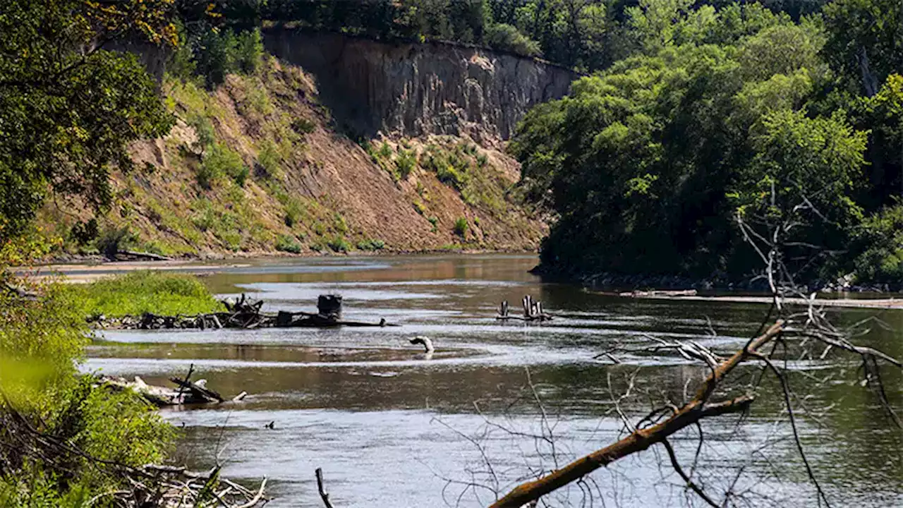 Brain-Eating Amoeba Suspected in 2nd Midwest Death