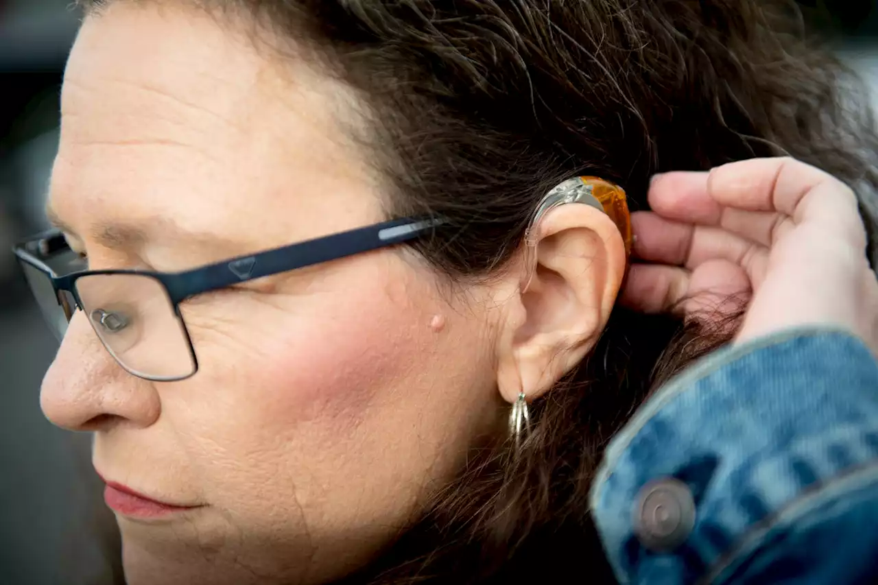 FDA moves to make over-the-counter hearing aids available to millions