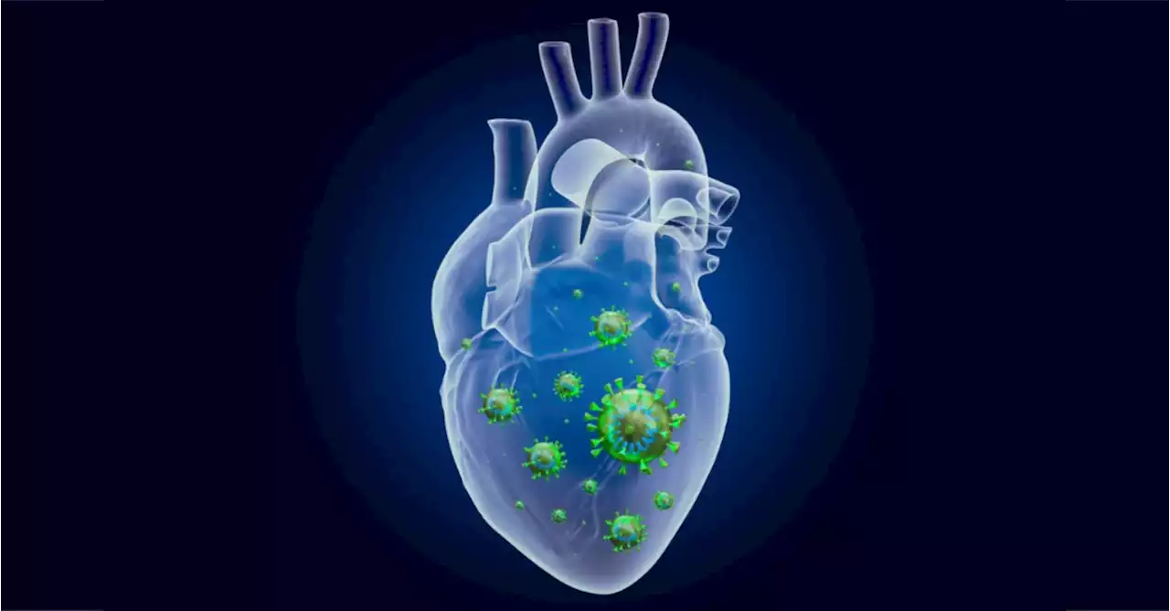 Myocarditis Risk Higher After COVID-19 Infection than After COVID-19 Vaccination