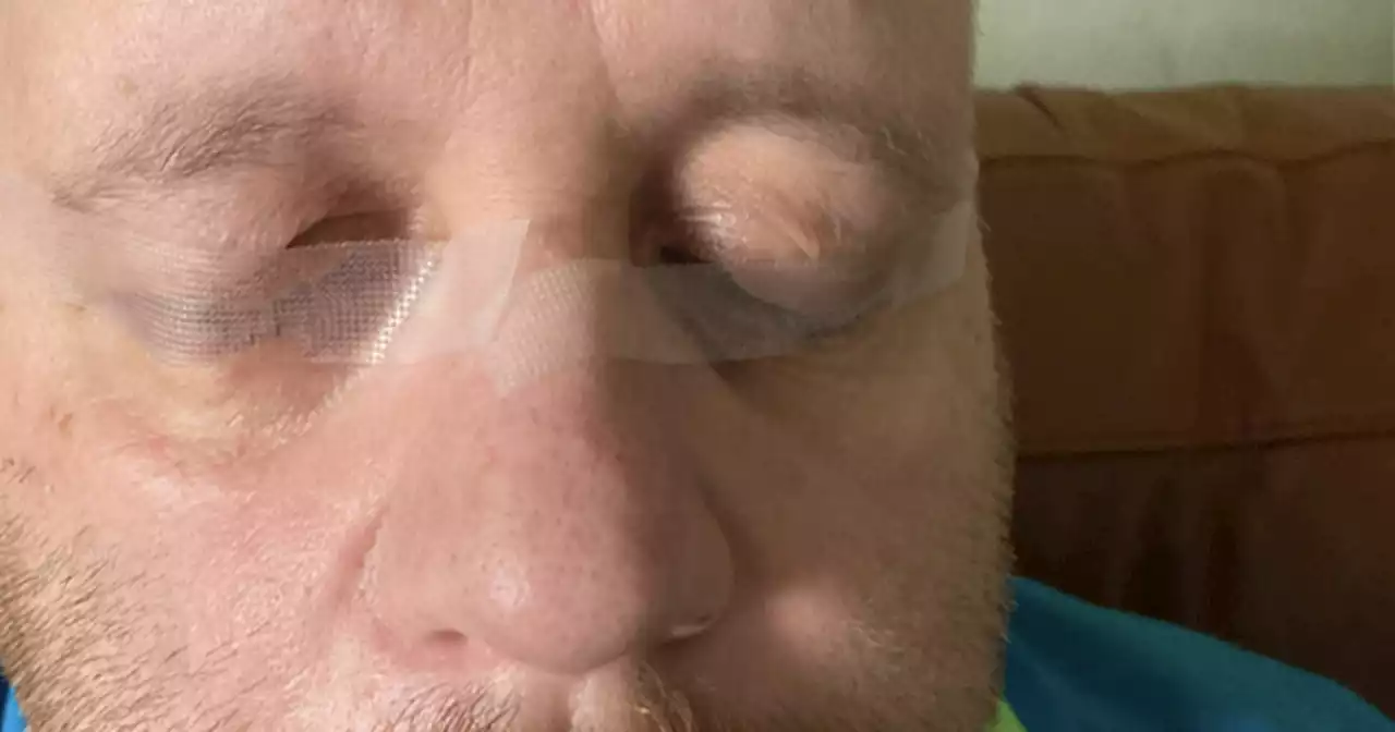 Newlywed man had to tape his eyes shut to sleep because of mystery illness