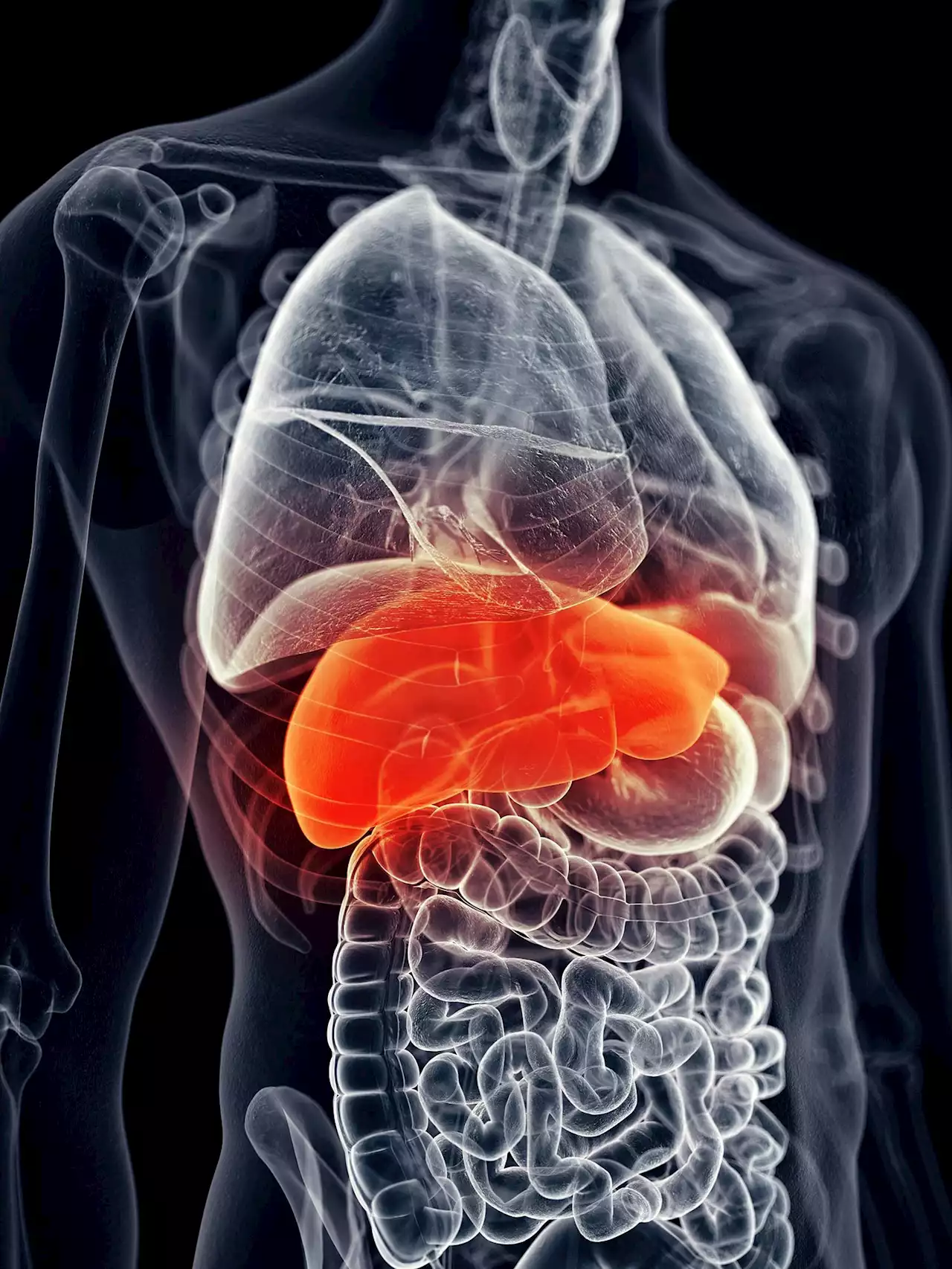 Liver Disease Linked to a 38% Higher Risk of Dementia