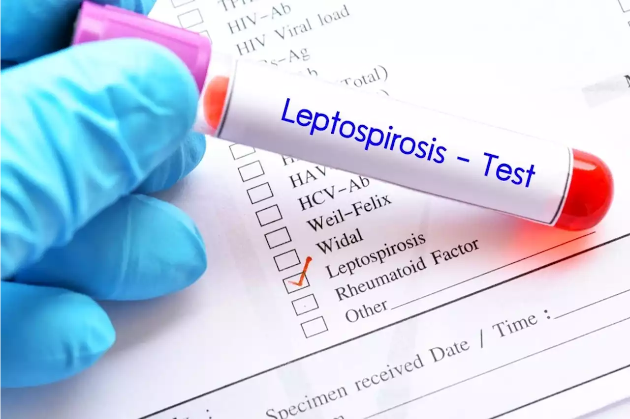 Early Diagnosis of Leptospirosis Using Au Nanoparticle Sensor