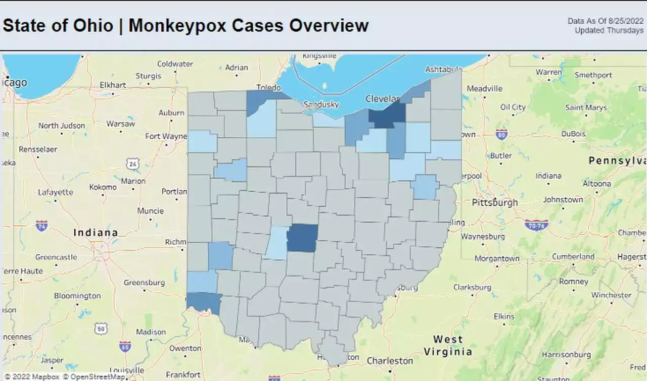 Ohio Department of Health launches new monkeypox data dashboard and interactive map showing locations of all 147 cases