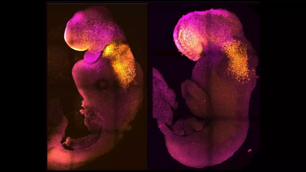 Lab-made mouse embryos grew brains and beating hearts, just like the real thing