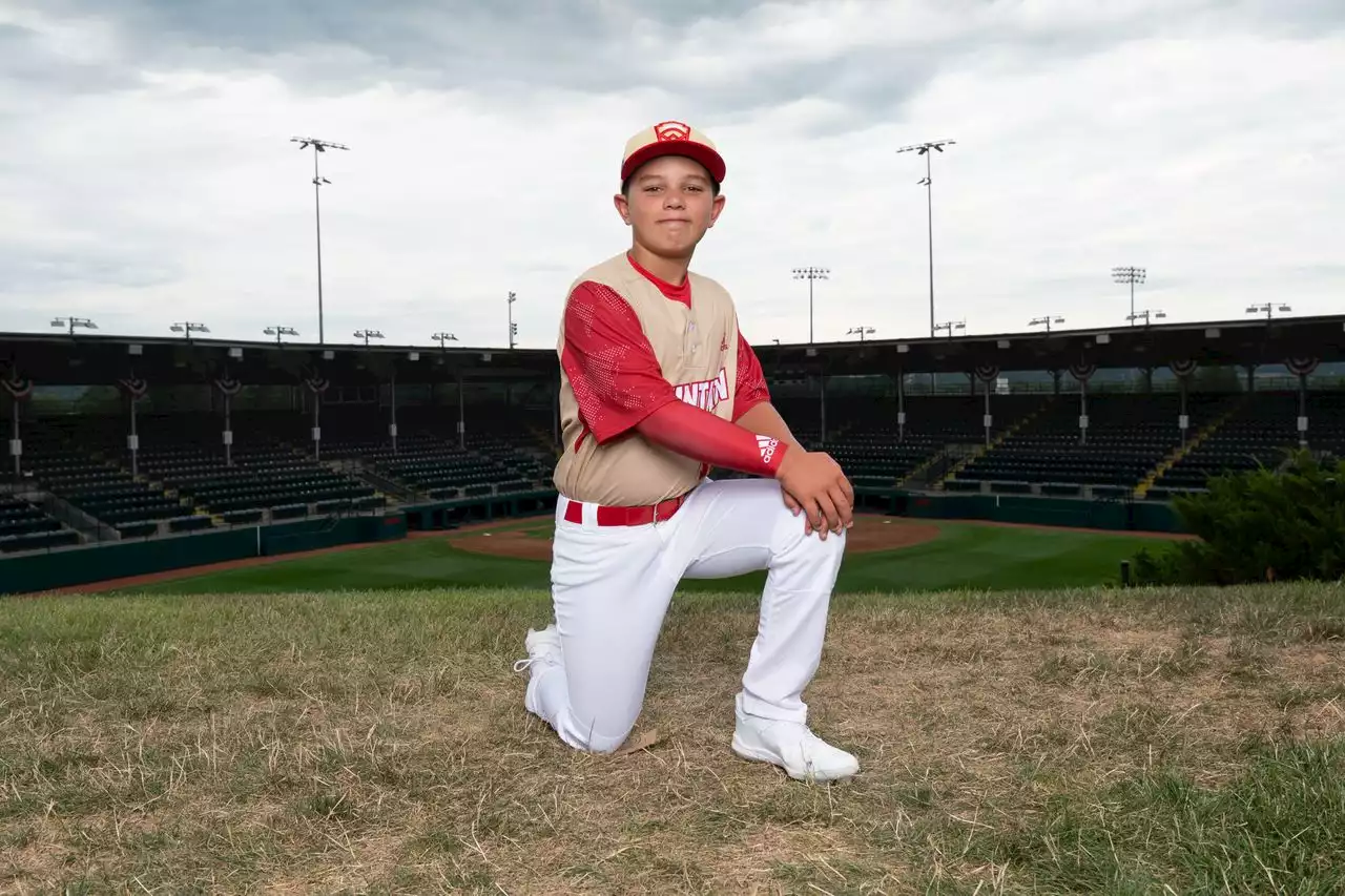 Injured Little League World Series player will undergo surgery to replace skull, family says