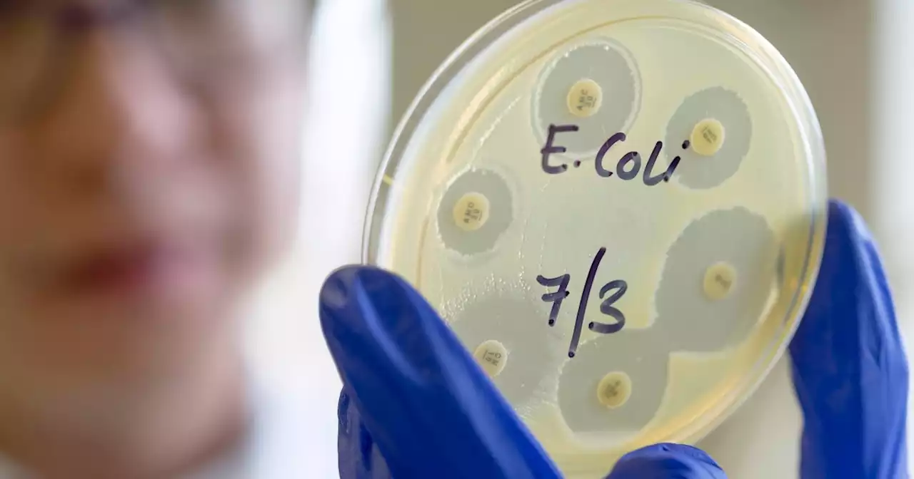 38 hospitalized in ongoing E. Coli outbreak, CDC still searching for the source