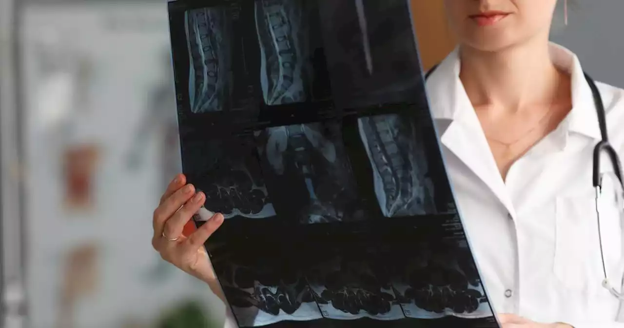 Children ‘must not be allowed to deteriorate’, groups say following spinal surgery cancellations