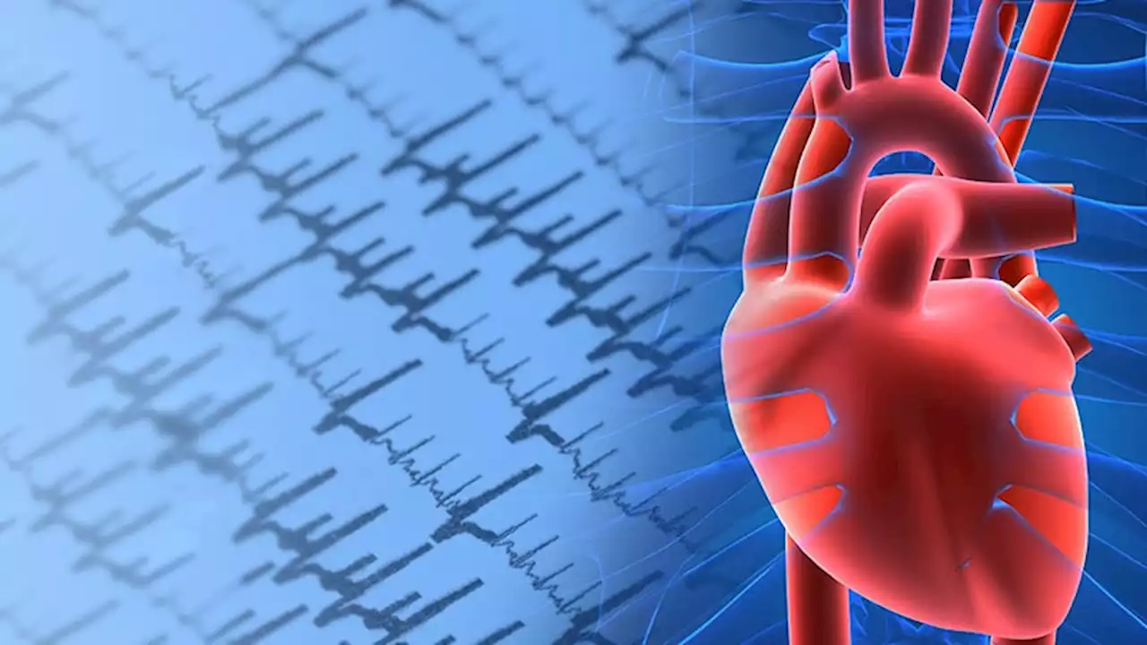 Rivaroxaban Outmatched by VKAs for AF in Rheumatic Heart Disease