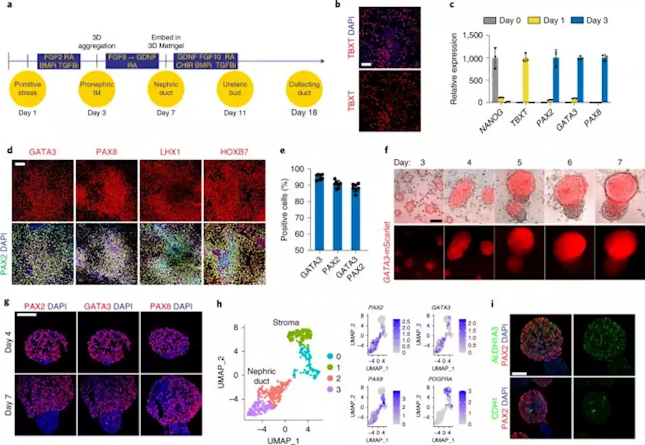 Human ureteric bud organoids recapitulate branching morphogenesis and differentiate into functional collecting duct cell types - Nature Biotechnology