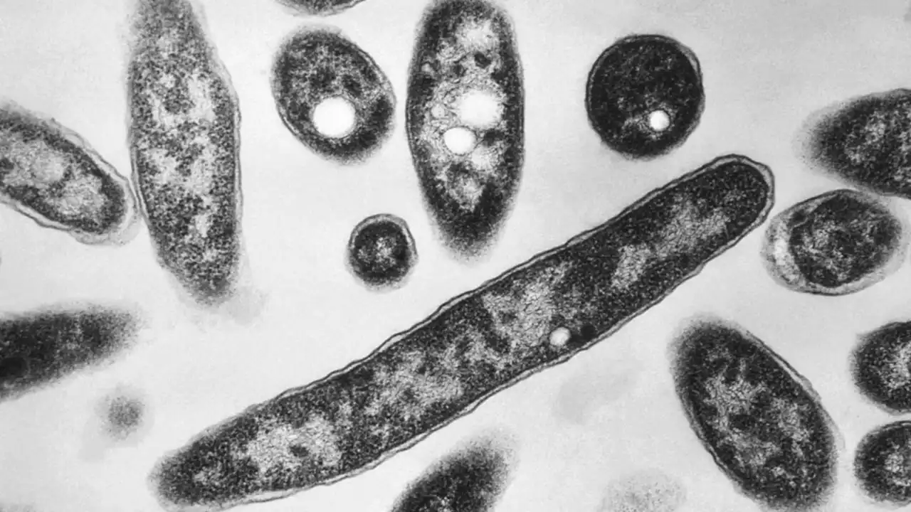 Legionnaires' disease outbreak in Napa County causes 1 death, several hospitalizations