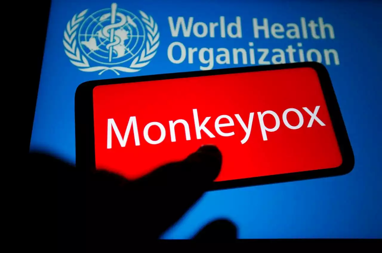 How many cases of monkeypox are in Alabama? Here is a daily count