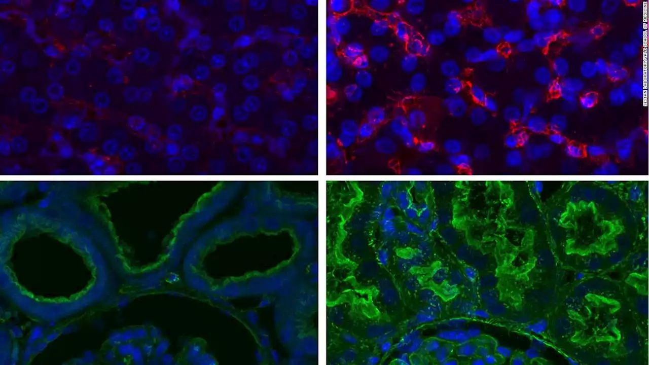 Research in pigs shakes up what we know about dying