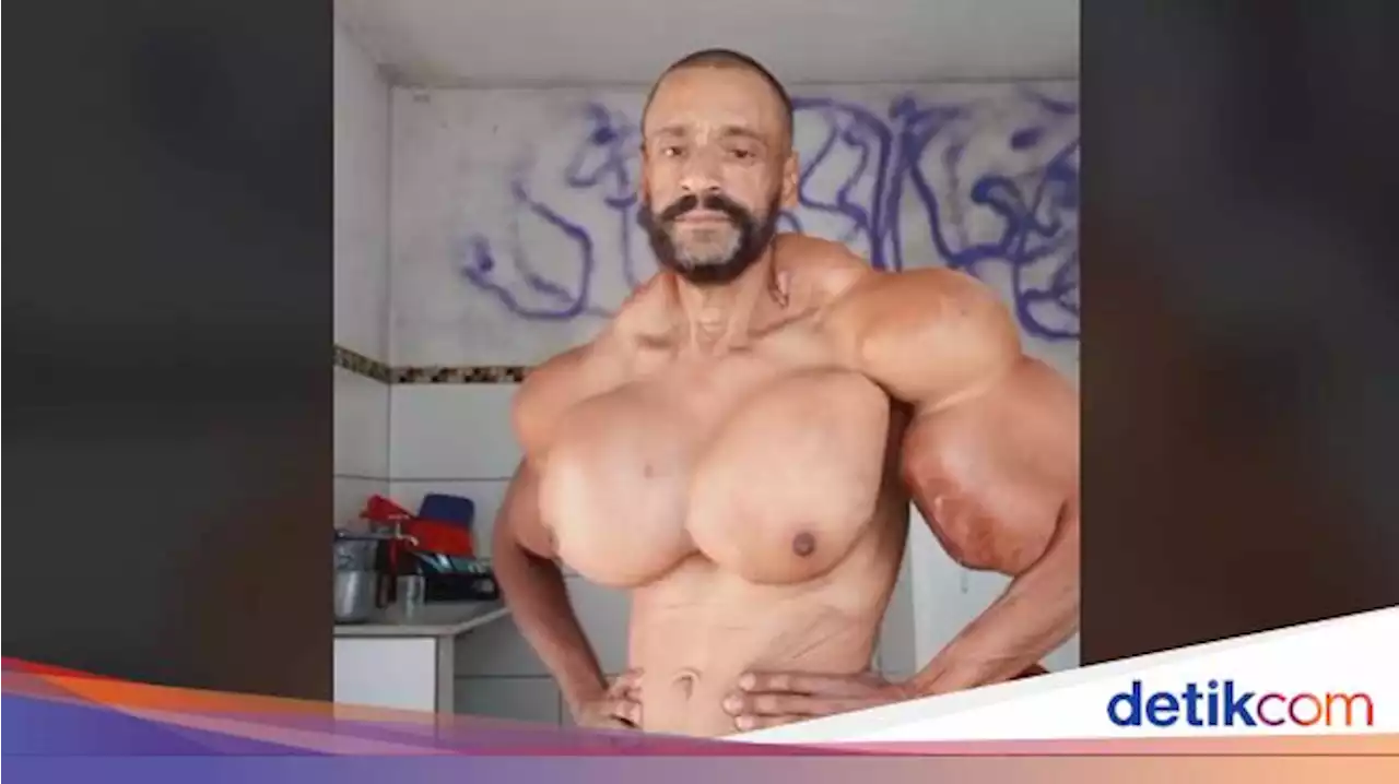 Sempat Viral karena Terobsesi Mirip Hulk, Binaragawan Ini Berakhir Tewas