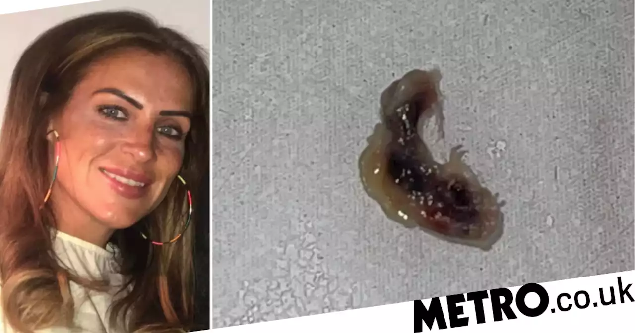 Mum felt a 'pop' when weird, slimy parasite crawled out from under her eyelid